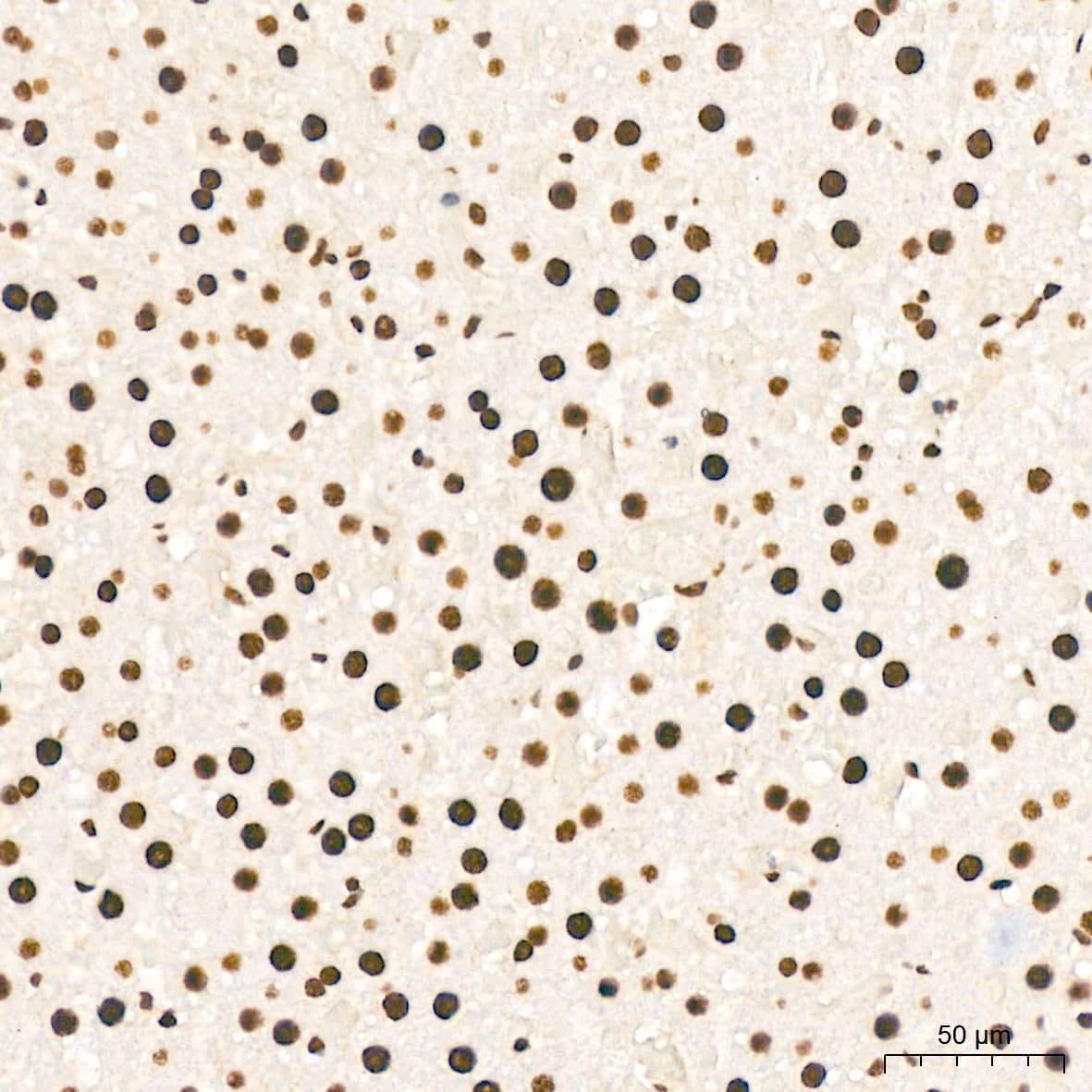 Immunohistochemistry: KHSRP Antibody (4V4O1) [NBP3-16746] - Immunohistochemistry analysis of KHSRP in paraffin-embedded rat liver tissue using KHSRP Rabbit mAb  at a dilution of 1:200 (40x lens).High pressure antigen retrieval was performed with 0.01 M citrate buffer (pH 6.0) prior to IHC staining.