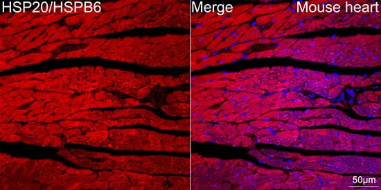 Immunocytochemistry/ Immunofluorescence: HSP20/HSPB6 Antibody (3J5N1) [NBP3-16751] - Confocal imaging of paraffin-embedded Mouse heart tissue using HSP20/HSPB6 Rabbit mAb  followed by a further incubation with Cy3 Goat Anti-Rabbit IgG (H+L)  . DAPI was used for nuclear staining (Blue). Objective: 40x. Perform high pressure antigen retrieval with 0.01 M citrate buffer (pH 6.0) prior to IF staining.