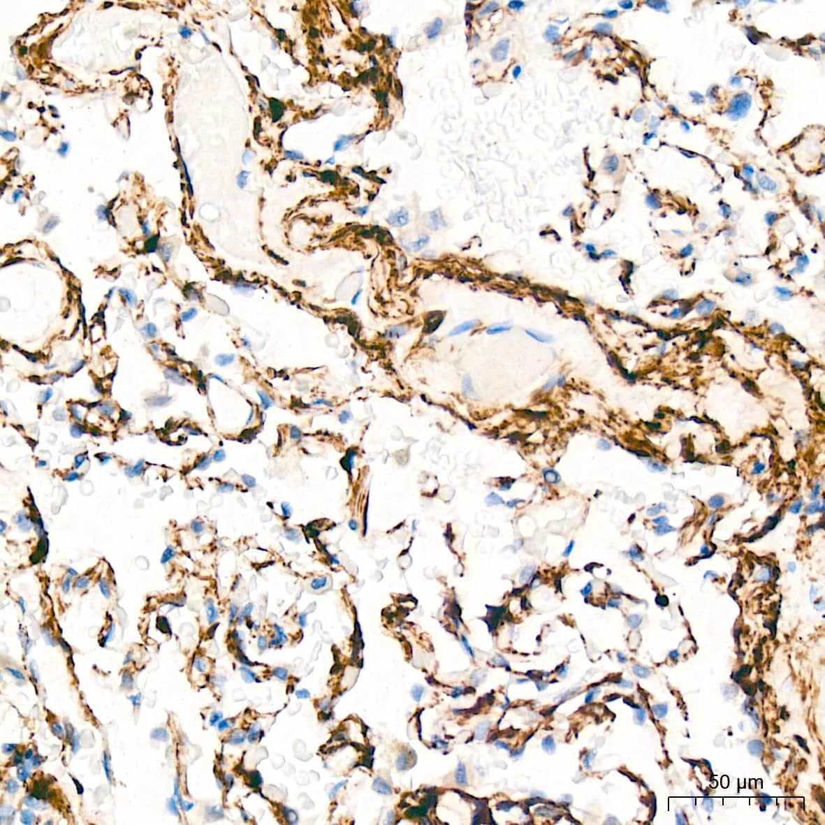 Immunohistochemistry HSP20/HSPB6 Antibody (3J5N1)