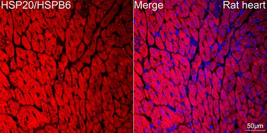 Immunocytochemistry/ Immunofluorescence: HSP20/HSPB6 Antibody (3J5N1) [NBP3-16751] - Confocal imaging of paraffin-embedded Rat heart tissue using HSP20/HSPB6 Rabbit mAb  followed by a further incubation with Cy3 Goat Anti-Rabbit IgG (H+L)  . DAPI was used for nuclear staining (Blue). Objective: 40x. Perform high pressure antigen retrieval with 0.01 M citrate buffer (pH 6.0) prior to IF staining.