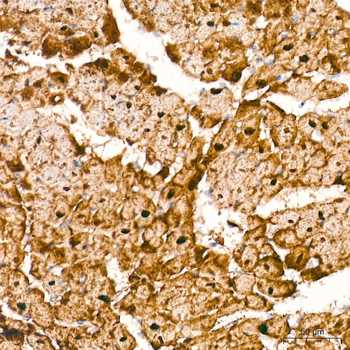 Immunohistochemistry HSP20/HSPB6 Antibody (3J5N1)