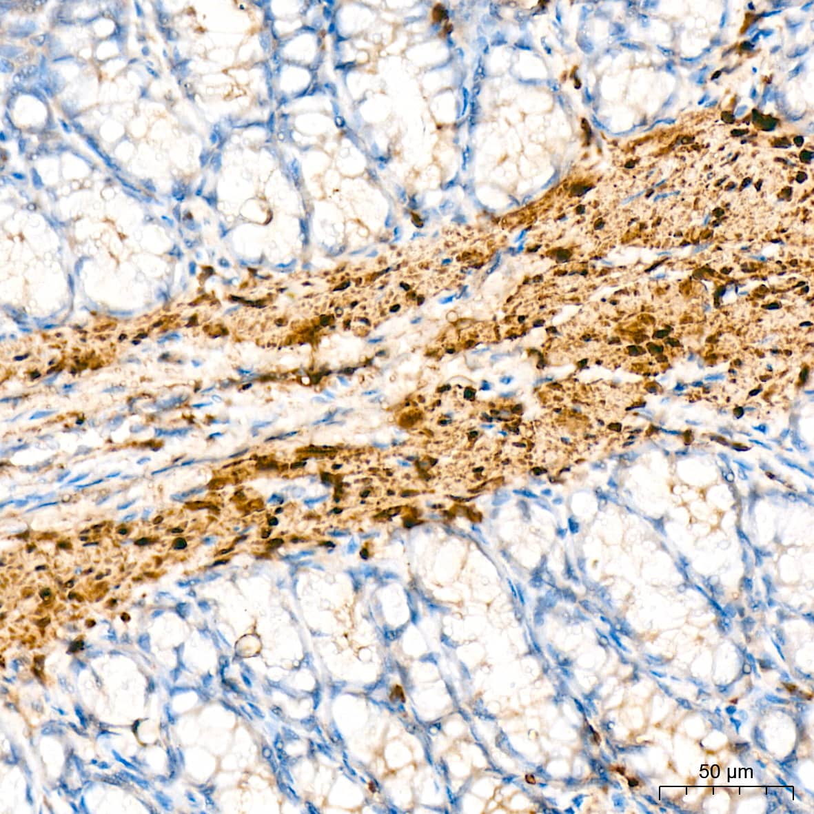 Immunohistochemistry: HSP20/HSPB6 Antibody (3J5N1) [NBP3-16751] - Immunohistochemistry analysis of HSP20/HSPB6 in paraffin-embedded rat colon tissue using HSP20/HSPB6 Rabbit mAb  at a dilution of 1:200 (40x lens). High pressure antigen retrieval was performed with 0.01 M Tris-EDTA buffer (pH 9.0) prior to IHC staining.