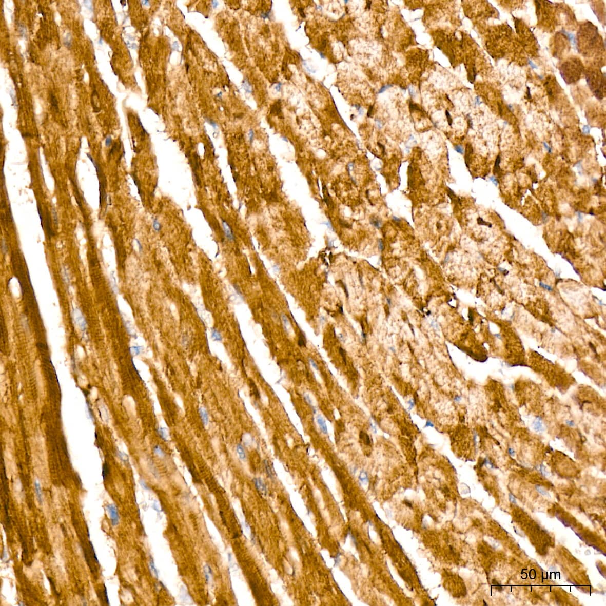 Immunohistochemistry: HSP20/HSPB6 Antibody (3J5N1) [NBP3-16751] - Immunohistochemistry analysis of HSP20/HSPB6 in paraffin-embedded mouse heart tissue using HSP20/HSPB6 Rabbit mAb  at a dilution of 1:200 (40x lens). High pressure antigen retrieval was performed with 0.01 M Tris-EDTA buffer (pH 9.0) prior to IHC staining.