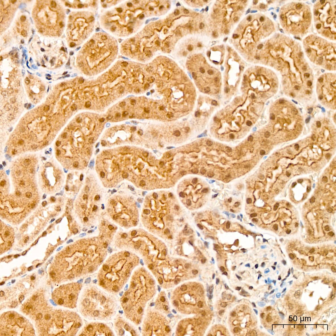 Immunohistochemistry: p70 S6 Kinase beta/S6K2 Antibody (5D8F5) [NBP3-16752] - Immunohistochemistry analysis of p70 S6 Kinase beta/S6K2 in paraffin-embedded mouse kidney tissue using p70 S6 Kinase beta/S6K2 Rabbit mAb  at a dilution of 1:200 (40x lens). High pressure antigen retrieval was performed with 0.01 M citrate buffer (pH 6.0) prior to IHC staining.