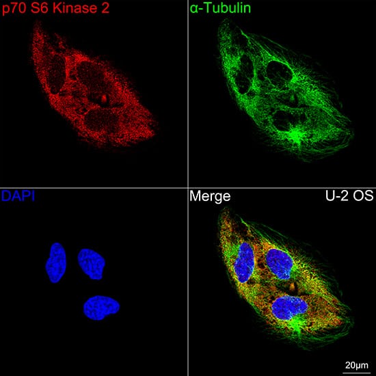 Immunocytochemistry/ Immunofluorescence: p70 S6 Kinase beta/S6K2 Antibody (5D8F5) [NBP3-16752] - Confocal imaging of U-2 OS cells using p70 S6 Kinase beta/S6K2 Rabbit mAb  followed by a further incubation with Cy3 Goat Anti-Rabbit IgG (H+L)  . The cells were counterstained with alpha-Tubulin Mouse mAb  followed by incubation with ABflo 488-conjugated Goat Anti-Mouse IgG (H+L) Ab  (Green). DAPI was used for nuclear staining (Blue). Objective: 100x.