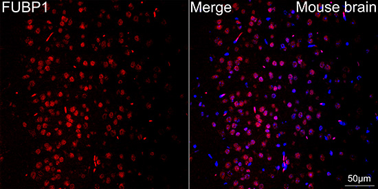 Immunocytochemistry/ Immunofluorescence TRBP Antibody (9E6C9)