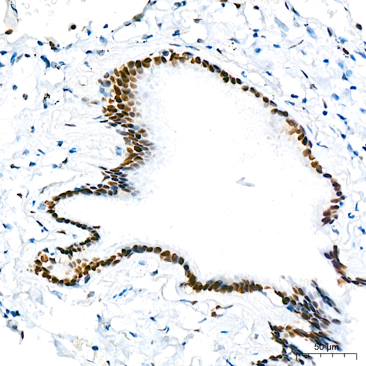 Immunohistochemistry TRBP Antibody (9E6C9)