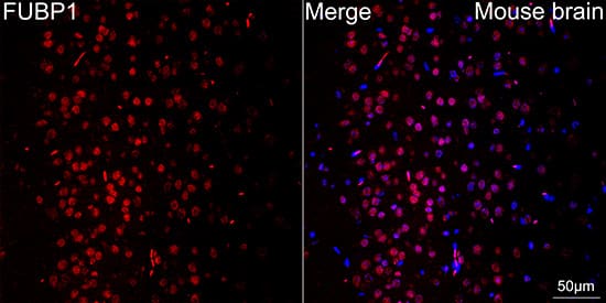 Immunocytochemistry/ Immunofluorescence: TRBP Antibody (9E6C9) [NBP3-16753] - Confocal imaging of paraffin-embedded Mouse brain tissue using TRBP Rabbit mAb  followed by a further incubation with Cy3 Goat Anti-Rabbit IgG (H+L)  . DAPI was used for nuclear staining (Blue). Objective: 40x. Perform microwave antigen retrieval with 0.01 M citrate buffer (pH 6.0) prior to IF staining.