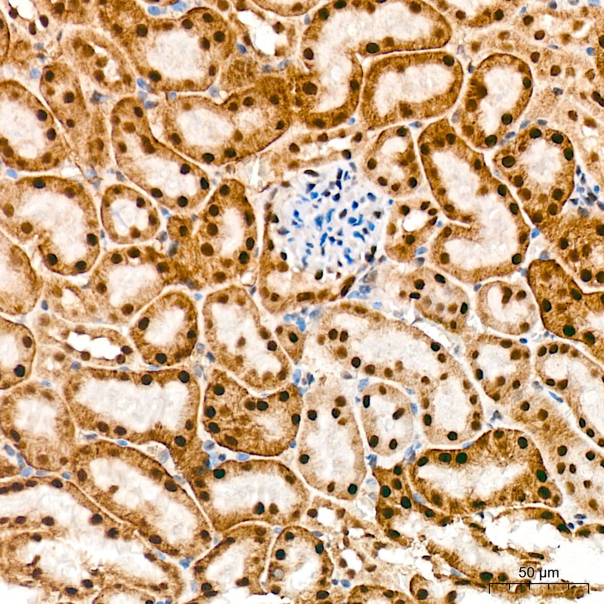 Immunohistochemistry TRBP Antibody (9E6C9)