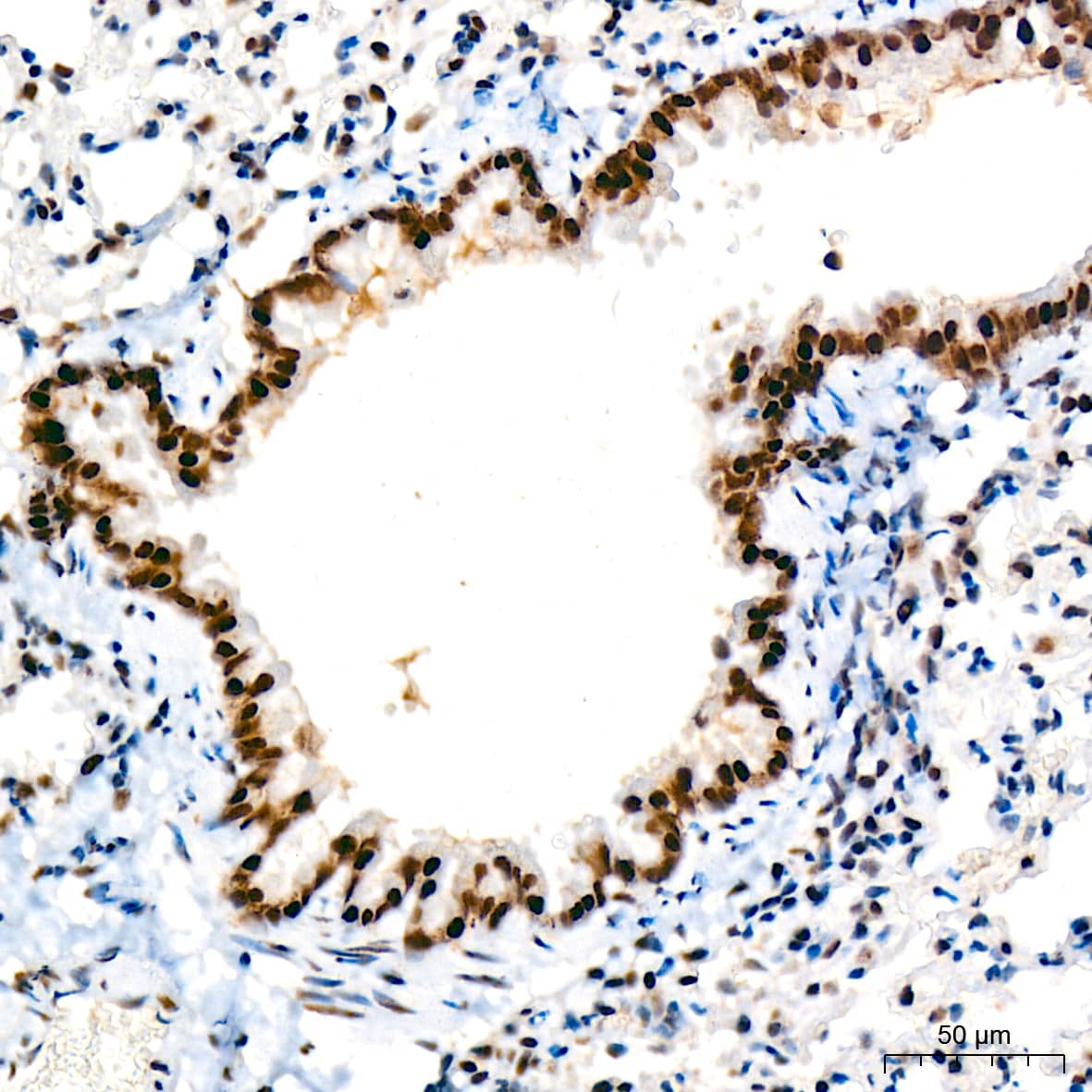 Immunohistochemistry: TRBP Antibody (9E6C9) [NBP3-16753] - Immunohistochemistry analysis of TRBP in paraffin-embedded mouse lung tissue using TRBP Rabbit mAb  at a dilution of 1:200 (40x lens). High pressure antigen retrieval was performed with 0.01 M citrate buffer (pH 6.0) prior to IHC staining.