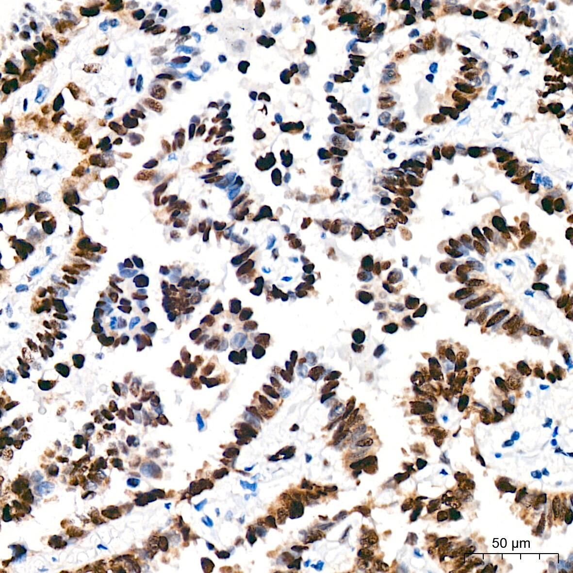 Immunohistochemistry TRBP Antibody (9E6C9)