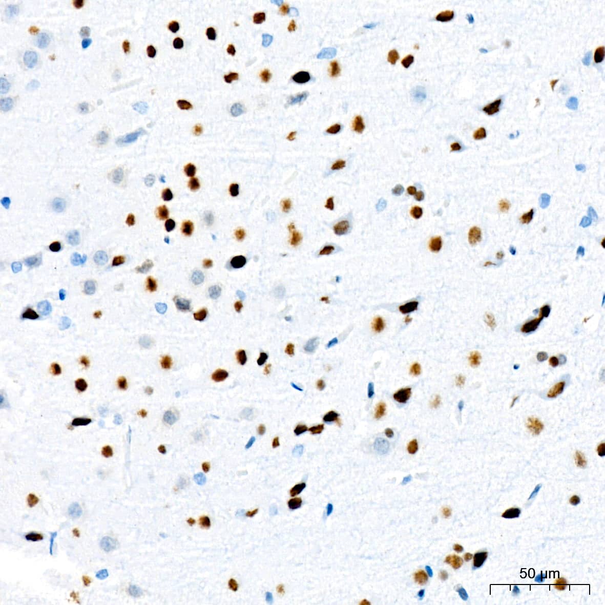 Immunohistochemistry: TRBP Antibody (9E6C9) [NBP3-16753] - Immunohistochemistry analysis of TRBP in paraffin-embedded rat brain tissue using TRBP Rabbit mAb  at a dilution of 1:200 (40x lens). High pressure antigen retrieval was performed with 0.01 M citrate buffer (pH 6.0) prior to IHC staining.