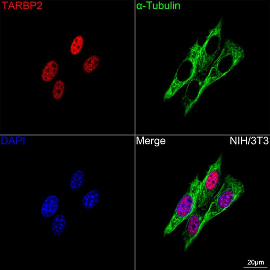 Immunocytochemistry/ Immunofluorescence: TRBP Antibody (9E6C9) [NBP3-16753] - Confocal imaging of NIH/3T3 cells using TRBP Rabbit mAb  followed by a further incubation with Cy3 Goat Anti-Rabbit IgG (H+L)  . The cells were counterstained with alpha-Tubulin Mouse mAb  followed by incubation with ABflo 488-conjugated Goat Anti-Mouse IgG (H+L) Ab  (Green). DAPI was used for nuclear staining (Blue). Objective: 100x.