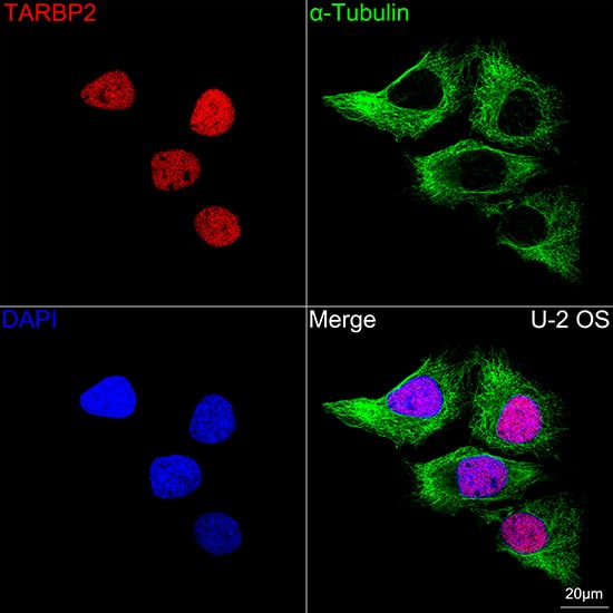 Immunocytochemistry/ Immunofluorescence: TRBP Antibody (9E6C9) [NBP3-16753] - Confocal imaging of U-2 OS cells using TRBP Rabbit mAb   followed by a further incubation with Cy3 Goat Anti-Rabbit IgG (H+L)  . The cells were counterstained with alpha-Tubulin Mouse mAb  followed by incubation with ABflo 488-conjugated Goat Anti-Mouse IgG (H+L) Ab  (Green). DAPI was used for nuclear staining (Blue). Objective: 100x.