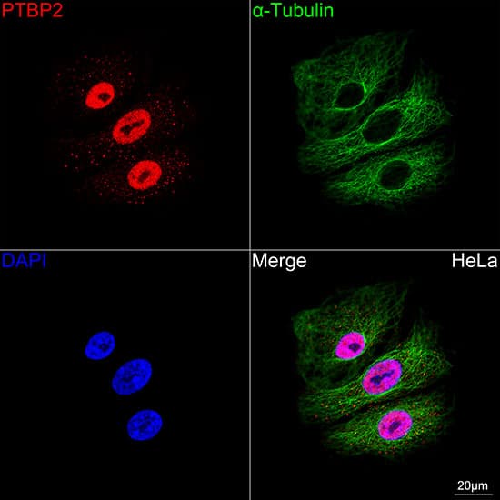 Immunocytochemistry/ Immunofluorescence: PTBP2 Antibody (10S9P6) [NBP3-16756] - Confocal imaging of A549 cells using PTBP2 Rabbit mAb followed by a further incubation with Cy3 Goat Anti-Rabbit IgG (H+L) . The cells were counterstained with alpha-Tubulin Mouse mAb followed by incubation with ABflo(R) 488-conjugated Goat Anti-Mouse IgG (H+L) Ab (Green). DAPI was used for nuclear staining (Blue). Objective: 100x.