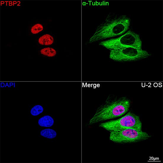 Immunocytochemistry/ Immunofluorescence PTBP2 Antibody (10S9P6)