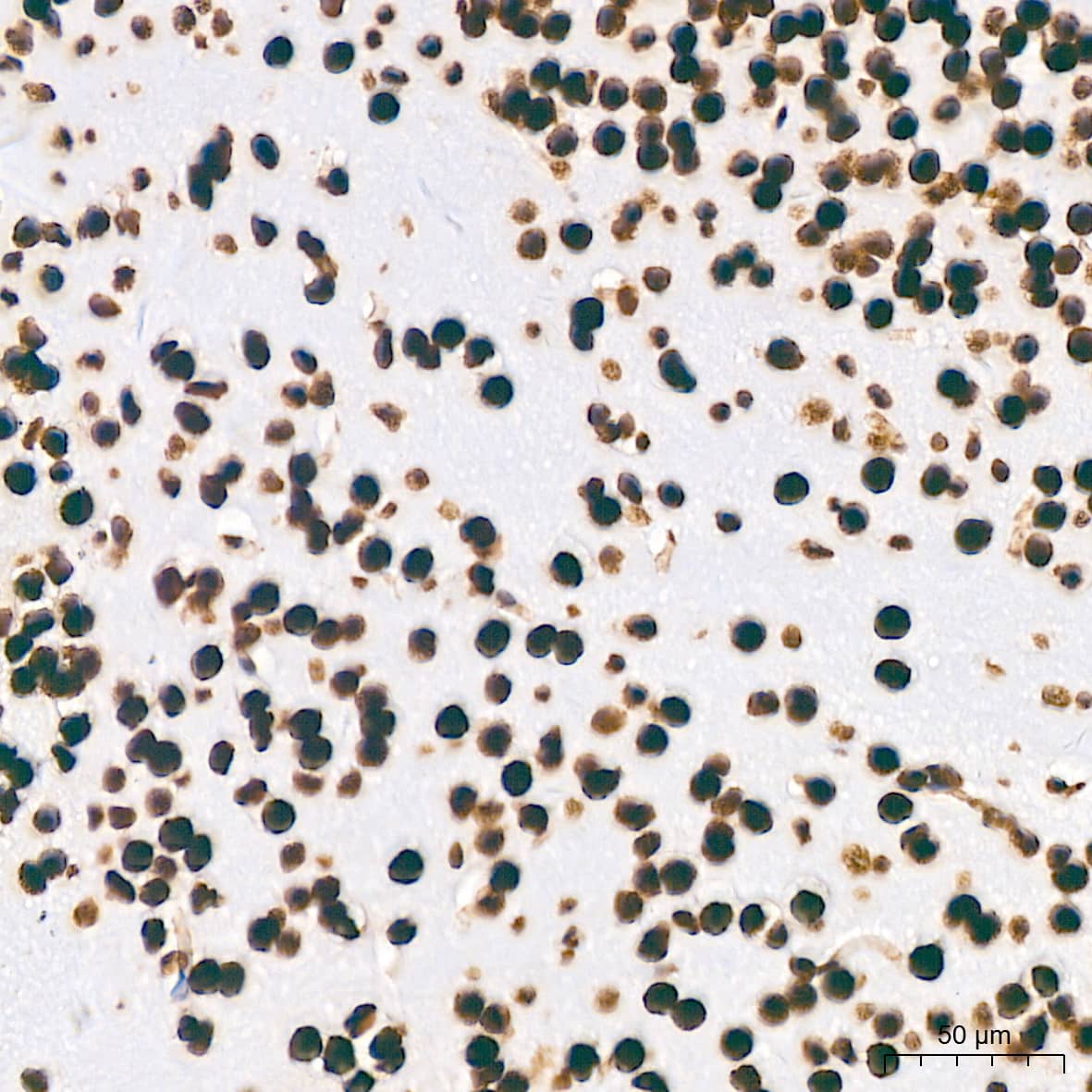 Immunohistochemistry: PTBP2 Antibody (10S9P6) [NBP3-16756] - Immunohistochemistry analysis of paraffin-embedded Mouse brain tissue using PTBP2 Rabbit mAb at a dilution of 1:800 (40x lens). High pressure antigen retrieval performed with 0.01M Tris-EDTA Buffer (pH 9.0) prior to IHC staining.