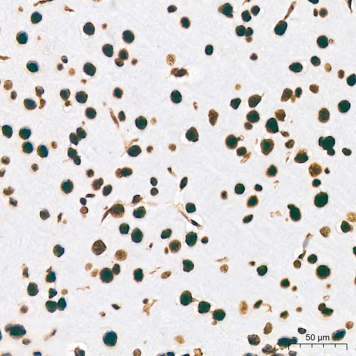 Immunohistochemistry: PTBP2 Antibody (10S9P6) [NBP3-16756] - Immunohistochemistry analysis of paraffin-embedded Rat brain tissue using PTBP2 Rabbit mAb at a dilution of 1:800 (40x lens). High pressure antigen retrieval performed with 0.01M Tris-EDTA Buffer (pH 9.0) prior to IHC staining.