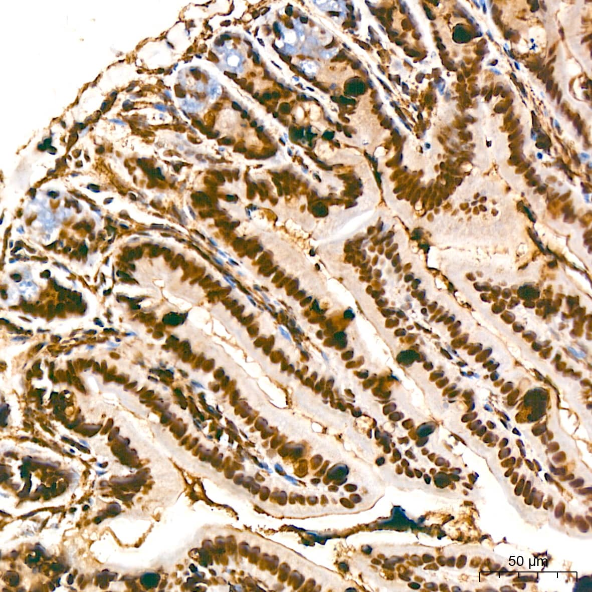 Immunohistochemistry: PTBP2 Antibody (10S9P6) [NBP3-16756] - Immunohistochemistry analysis of paraffin-embedded Mouse intestin tissue using PTBP2 Rabbit mAb at a dilution of 1:800 (40x lens). High pressure antigen retrieval performed with 0.01M Tris-EDTA Buffer (pH 9.0) prior to IHC staining.