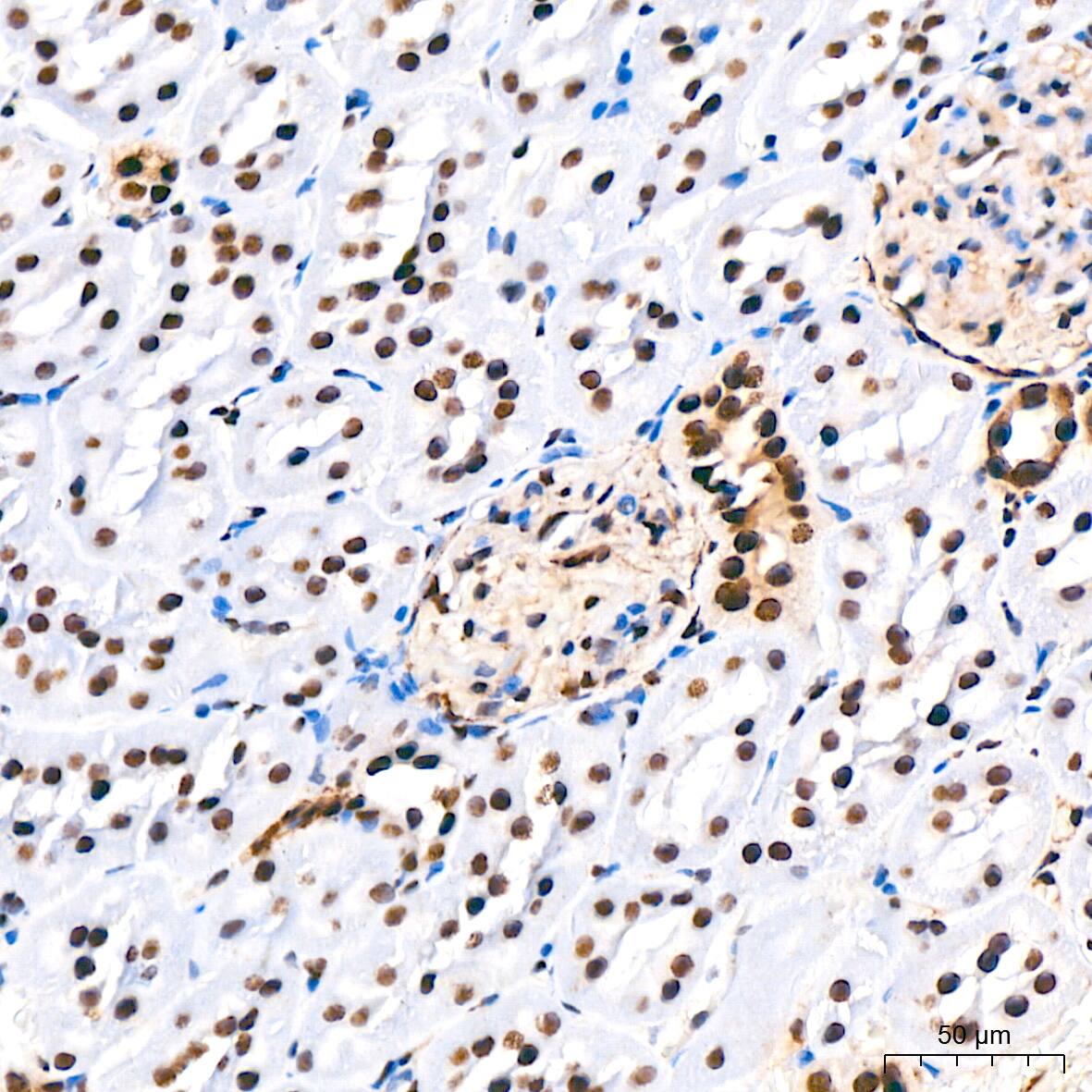 Immunohistochemistry: PTBP2 Antibody (10S9P6) [NBP3-16756] - Immunohistochemistry analysis of paraffin-embedded Rat kidney tissue using PTBP2 Rabbit mAb at a dilution of 1:800 (40x lens). High pressure antigen retrieval performed with 0.01M Tris-EDTA Buffer (pH 9.0) prior to IHC staining.