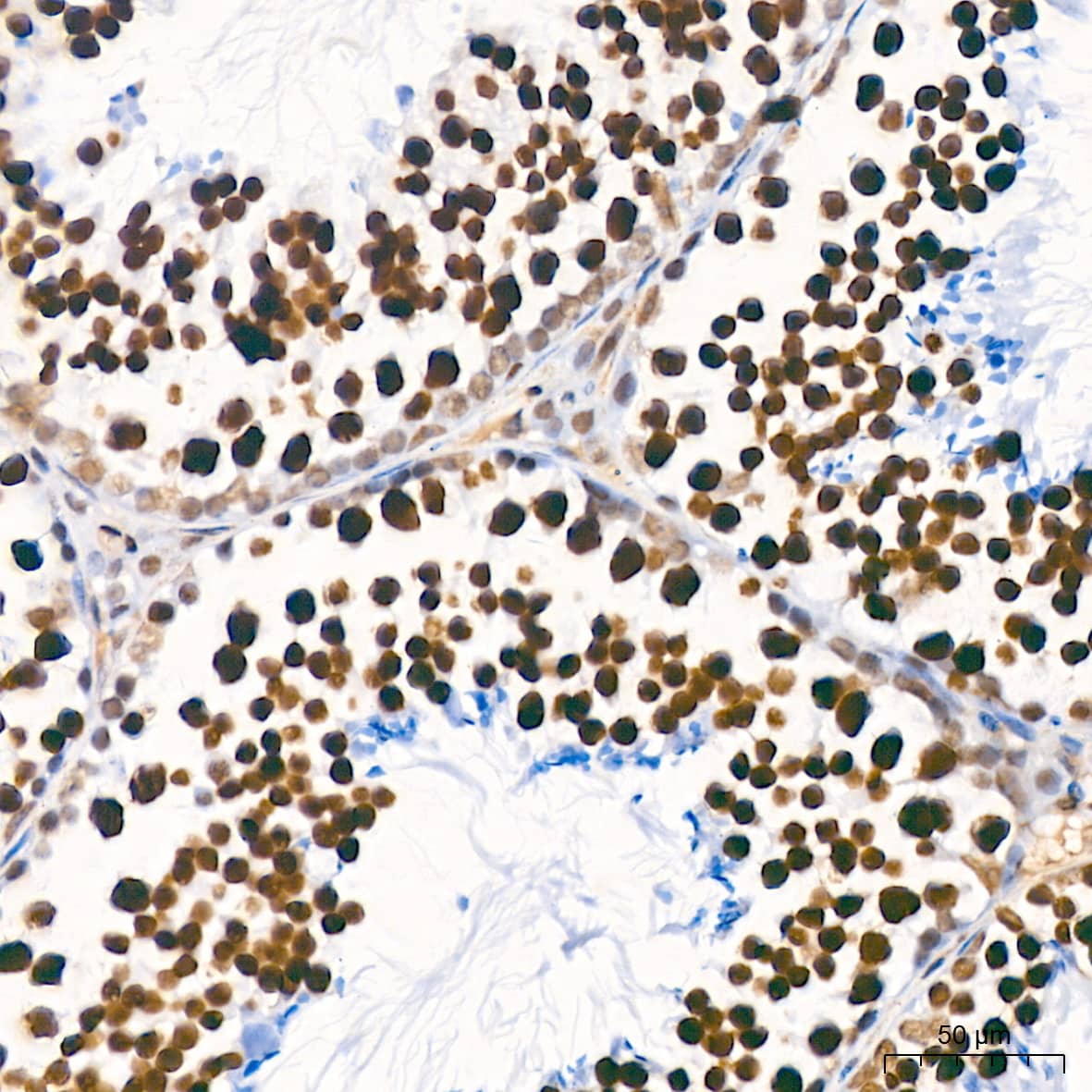 Immunohistochemistry: PTBP2 Antibody (10S9P6) [NBP3-16756] - Immunohistochemistry analysis of paraffin-embedded Mouse testis tissue using PTBP2 Rabbit mAb at a dilution of 1:800 (40x lens). High pressure antigen retrieval performed with 0.01M Tris-EDTA Buffer (pH 9.0) prior to IHC staining.