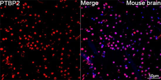 Immunocytochemistry/ Immunofluorescence: PTBP2 Antibody (10S9P6) [NBP3-16756] - Confocal imaging of paraffin-embedded Mouse brain using PTBP2 Rabbit mAb followed by a further incubation with Cy3 Goat Anti-Rabbit IgG (H+L) . DAPI was used for nuclear staining (Blue). Objective: 40x. Perform microwave antigen retrieval with 0.01 M citrate buffer (pH 6.0) prior to IF staining.