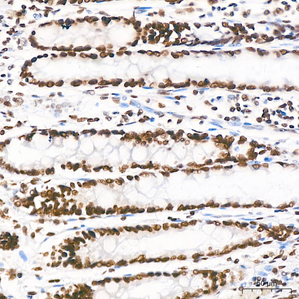 Immunohistochemistry: PTBP2 Antibody (10S9P6) [PTBP2] - Immunohistochemistry analysis of paraffin-embedded Human colon tissue using PTBP2 Rabbit mAb  at a dilution of 1:800 (40x lens). High pressure antigen retrieval performed with 0.01M Tris-EDTA Buffer (pH 9.0) prior to IHC staining.