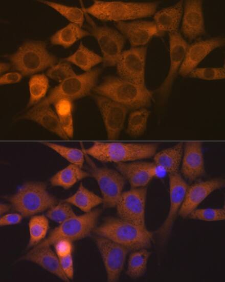 Immunocytochemistry/ Immunofluorescence: NCK1 Antibody (4R1N9) [NBP3-16759] - Immunofluorescence analysis of NIH-3T3 cells using NCK11 Rabbit mAb at dilution of 1:100 (40x lens). Secondary antibody: Cy3 Goat Anti-Rabbit IgG (H+L) at 1:500 dilution. Blue: DAPI for nuclear staining.