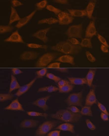 Immunocytochemistry/ Immunofluorescence: Ephrin-A1 Antibody (5D4Q5) [NBP3-16761] - Immunofluorescence analysis of NIH-3T3 cells using Ephrin-A1 Rabbit mAb at dilution of 1:100 (40x lens). Secondary antibody: Cy3 Goat Anti-Rabbit IgG (H+L) at 1:500 dilution. Blue: DAPI for nuclear staining.