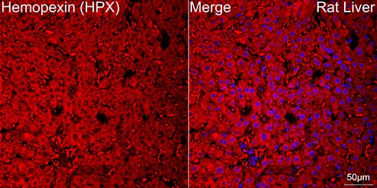 Immunocytochemistry/ Immunofluorescence: Hemopexin Antibody (1M6O3) [NBP3-16762] - Confocal imaging of paraffin-embedded Rat liver using Hemopexin Rabbit mAb followed by a further incubation with Cy3 Goat Anti-Rabbit IgG (H+L) . DAPI was used for nuclear staining (Blue). Objective: 40x. Perform high pressure antigen retrieval with 0.01 M citrate buffer (pH 6.0) prior to IF staining.