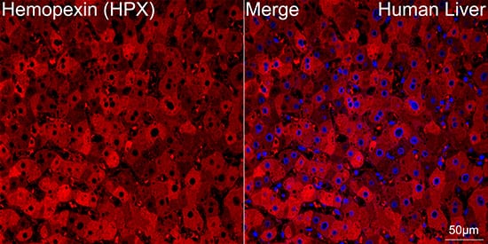 Immunocytochemistry/ Immunofluorescence: Hemopexin Antibody (1M6O3) [NBP3-16762] - Confocal imaging of paraffin-embedded Human liver using Hemopexin Rabbit mAb followed by a further incubation with Cy3 Goat Anti-Rabbit IgG (H+L) . DAPI was used for nuclear staining (Blue). Objective: 40x. Perform high pressure antigen retrieval with 0.01 M citrate buffer (pH 6.0) prior to IF staining.