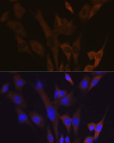 Immunocytochemistry/ Immunofluorescence: ABCE1 Antibody (1N4I7) [NBP3-16763] - Immunofluorescence analysis of NIH-3T3 cells using ABCE1 Rabbit mAb  at dilution of 1:100 (40x lens). Blue: DAPI for nuclear staining.