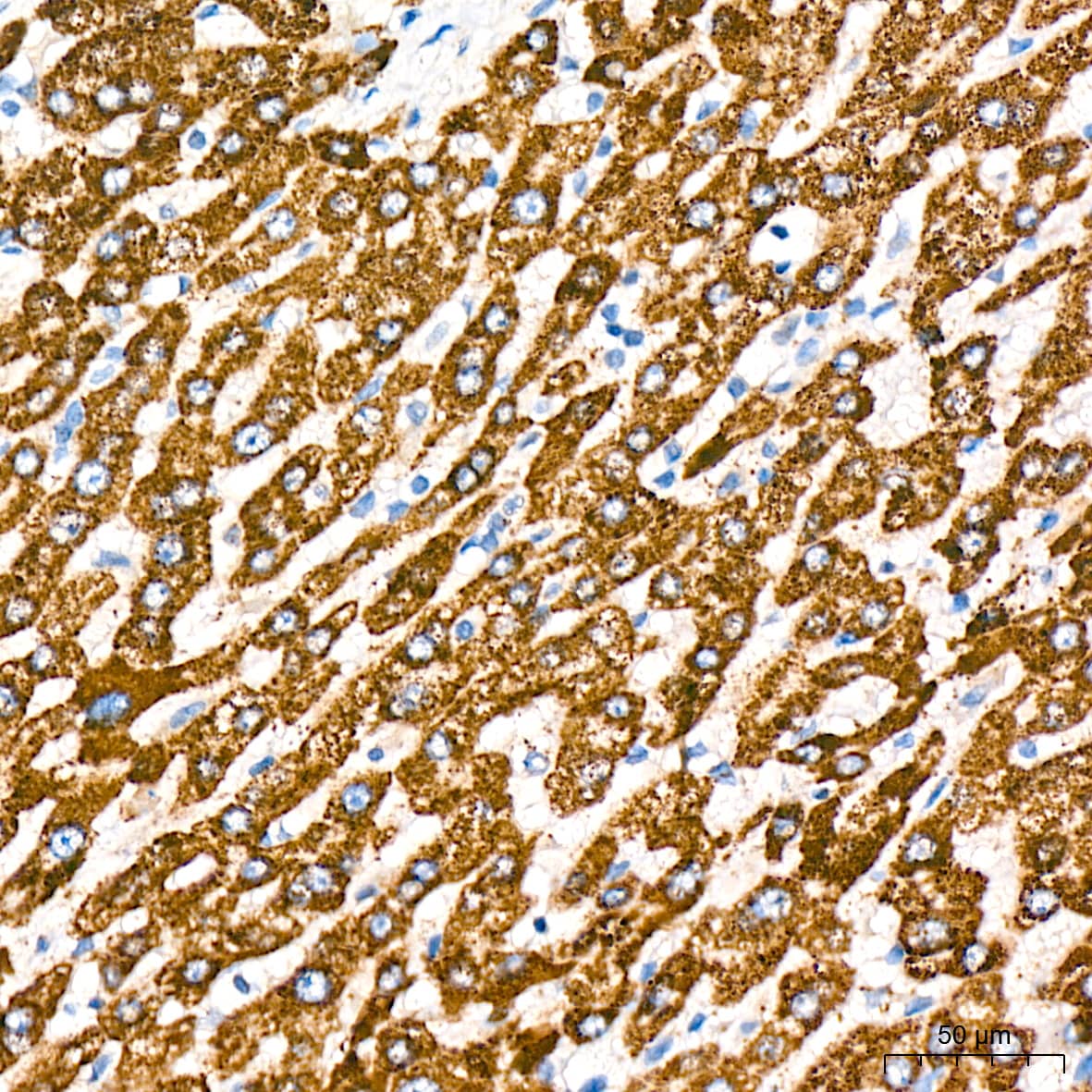 Immunohistochemistry: ABAT Antibody (10V1K9) [NBP3-16767] - Immunohistochemistry analysis of paraffin-embedded Human liver tissue using GABA transaminase Rabbit mAb at a dilution of 1:200 (40x lens). High pressure antigen retrieval was performed with 0.01 M citrate buffer (pH 6.0) prior to IHC staining.