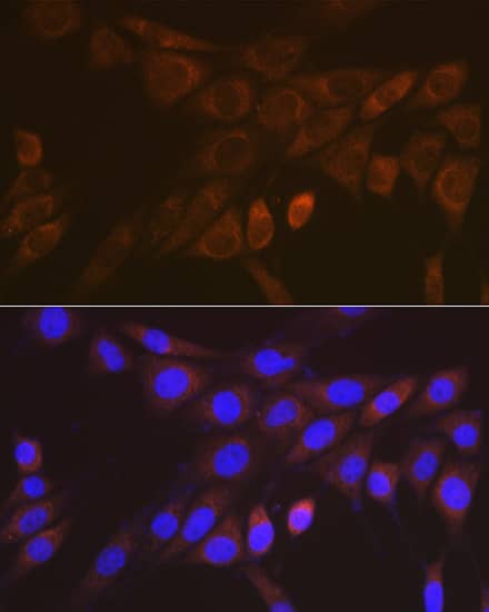 Immunocytochemistry/ Immunofluorescence: 14-3-3 zeta/beta Antibody (3J3J9) [NBP3-16769] - Immunofluorescence analysis of NIH-3T3 cells using 14-3-3 zeta/beta Rabbit mAb  at dilution of 1:100 (40x lens). Blue: DAPI for nuclear staining.