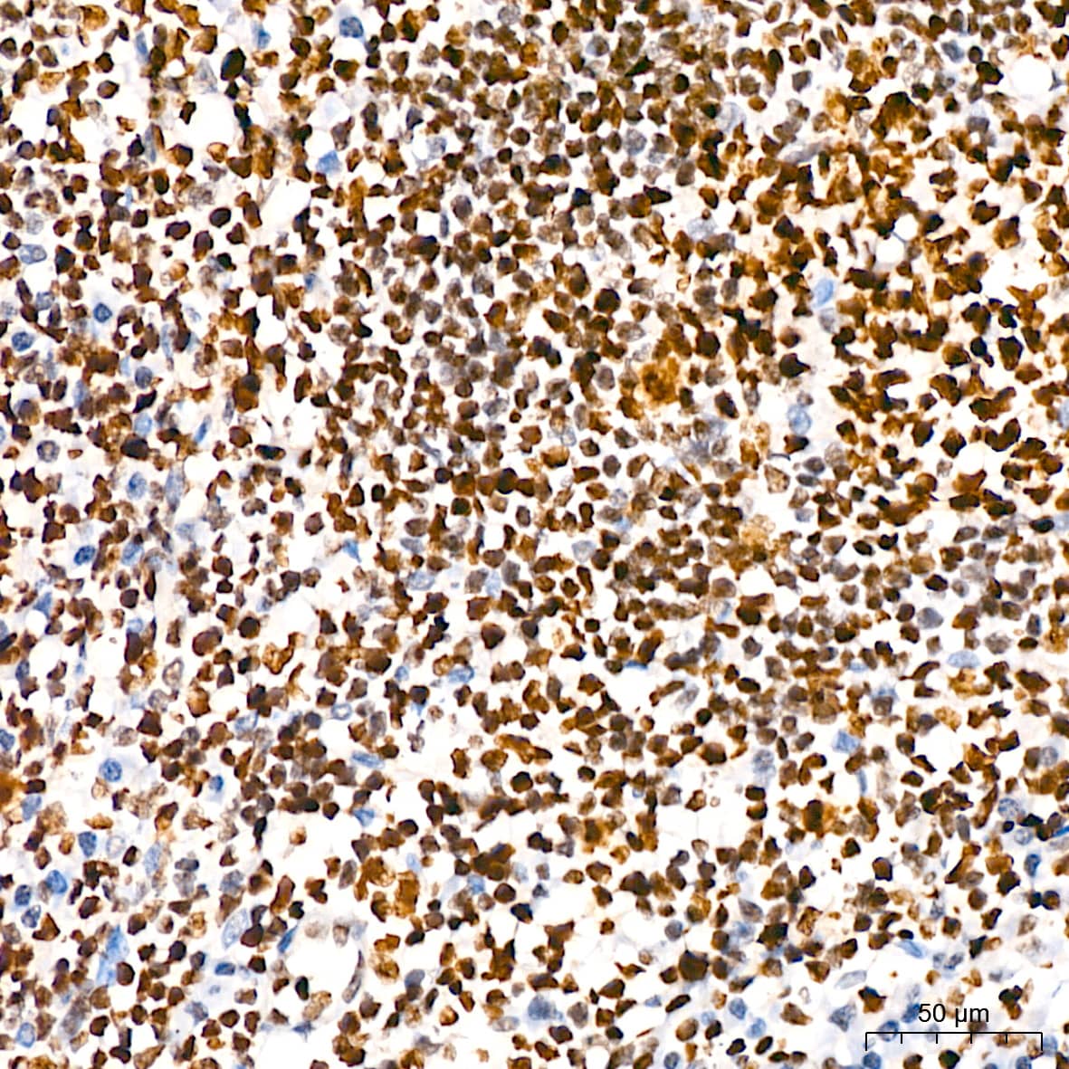 Immunohistochemistry HMGB2 Antibody (8P10V5)