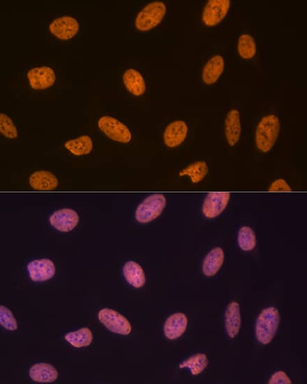 Immunocytochemistry/ Immunofluorescence: SET Antibody (8E8M9) [NBP3-16775] - Immunofluorescence analysis of U-2 OS cells using SET Rabbit mAb at dilution of 1:100 (40x lens). Secondary antibody: Cy3 Goat Anti-Rabbit IgG (H+L) at 1:500 dilution. Blue: DAPI for nuclear staining.