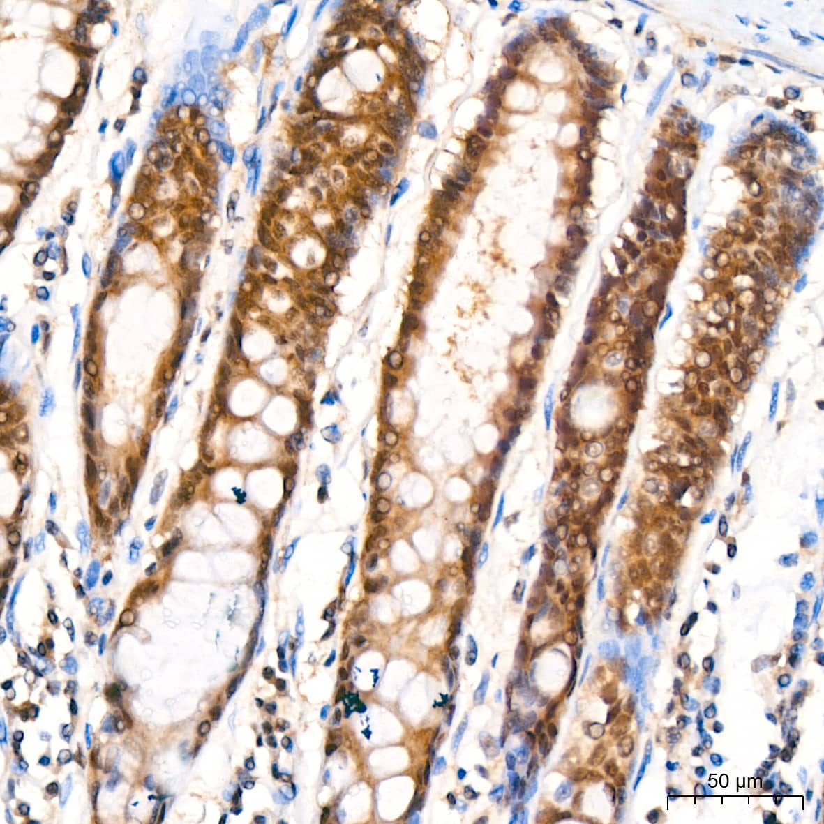 Immunohistochemistry: PSMA2 Antibody (6L5H4) [NBP3-16778] - Immunohistochemistry analysis of PSMA2 in paraffin-embedded human colon tissue using PSMA2 Rabbit mAb  at a dilution of 1:200 (40x lens).High pressure antigen retrieval was performed with 0.01 M citrate buffer (pH 6.0) prior to IHC staining.