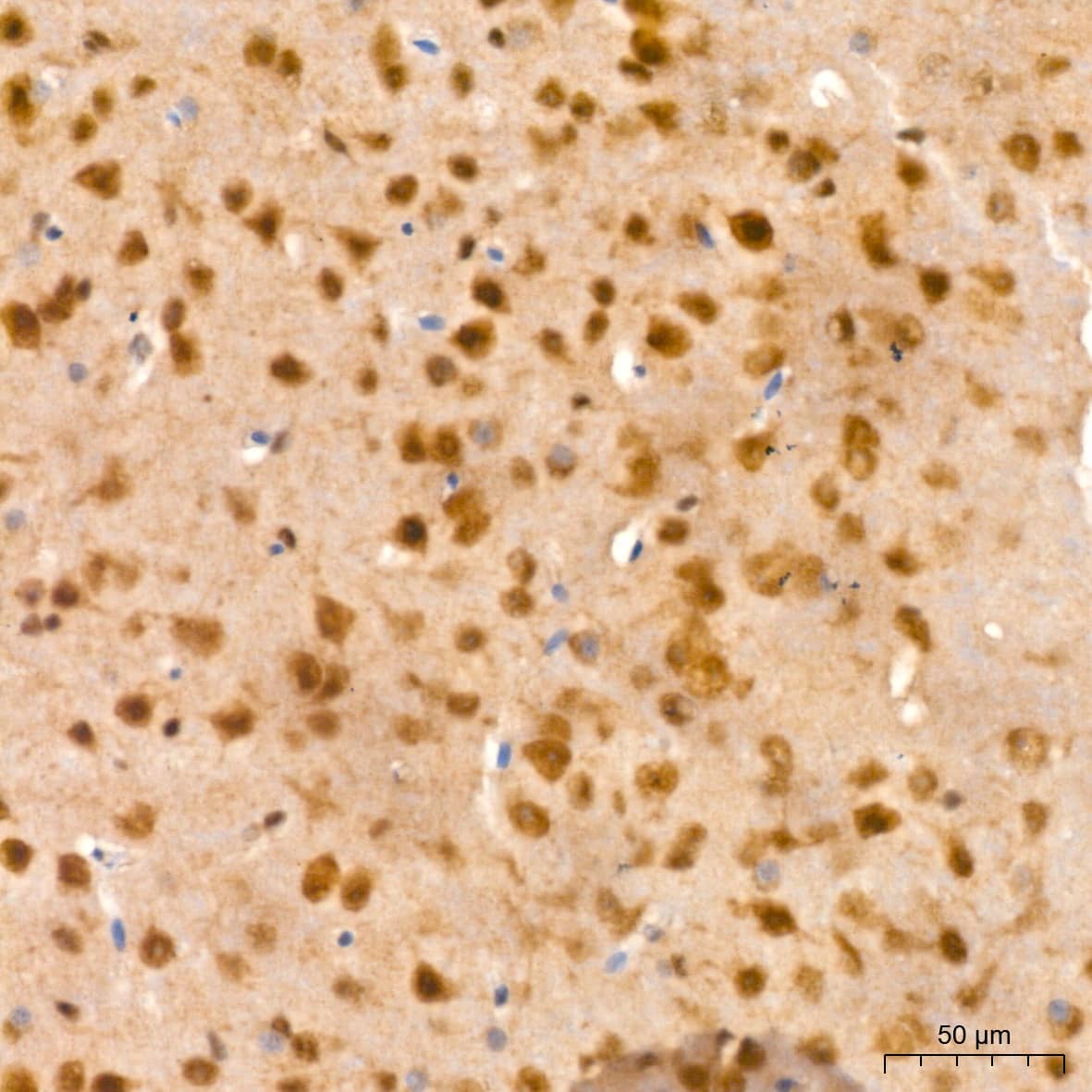 Immunohistochemistry: PSMA2 Antibody (6L5H4) [NBP3-16778] - Immunohistochemistry analysis of PSMA2 in paraffin-embedded mouse brain tissue using PSMA2 Rabbit mAb  at a dilution of 1:200 (40x lens).High pressure antigen retrieval was performed with 0.01 M citrate buffer (pH 6.0) prior to IHC staining.