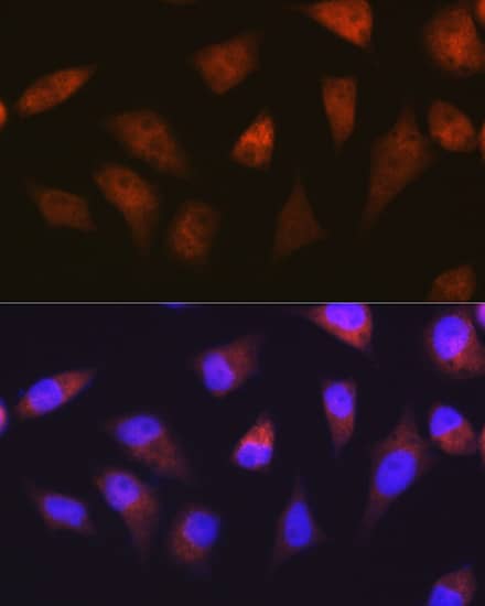 Immunocytochemistry/ Immunofluorescence: PSMA2 Antibody (6L5H4) [NBP3-16778] - Immunofluorescence analysis of HeLa cells using PSMA2 Rabbit mAb  at dilution of 1:100 (40x lens). Secondary antibody: Cy3 Goat Anti-Rabbit IgG (H+L)  at 1:500 dilution. Blue: DAPI for nuclear staining.