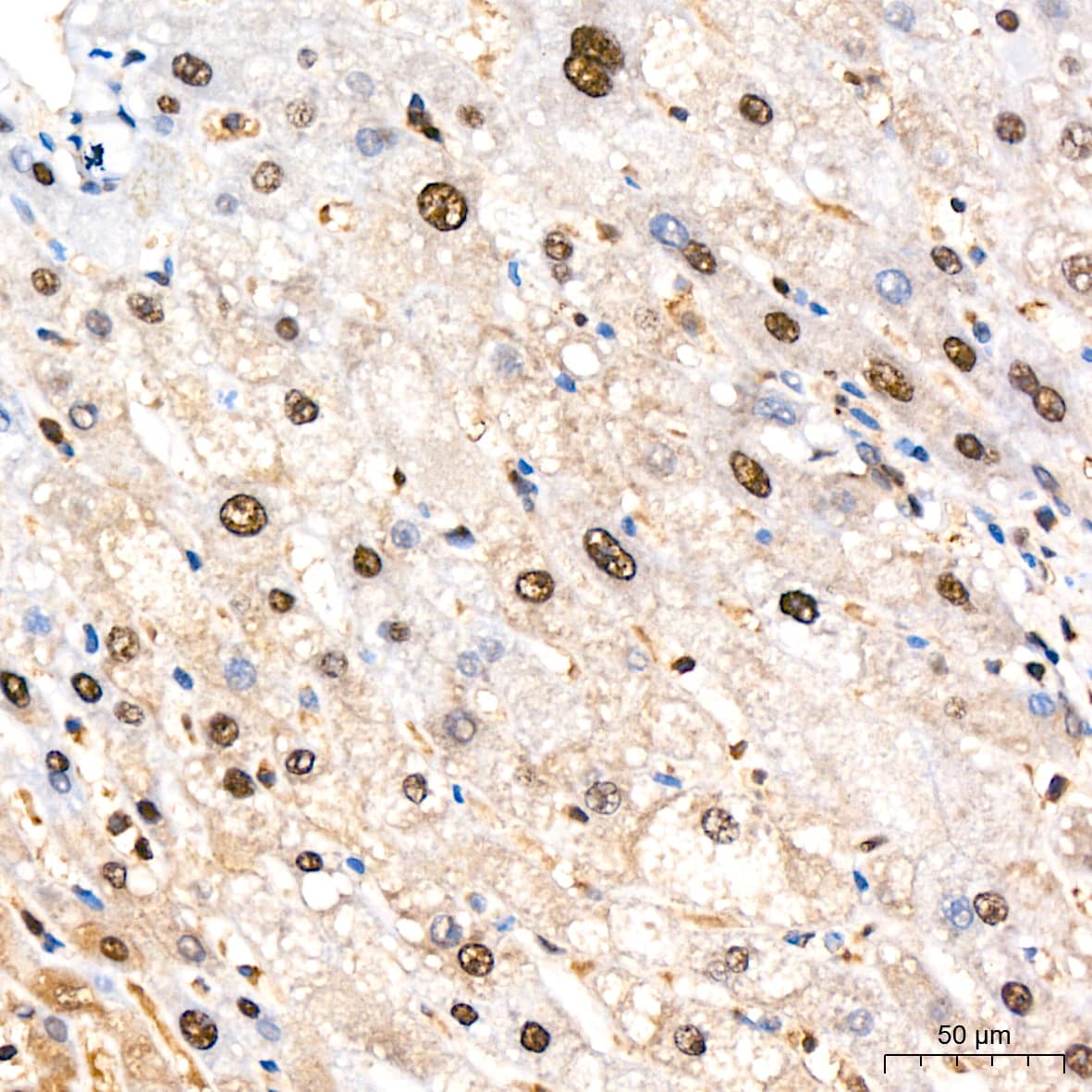 Immunohistochemistry: PSMA2 Antibody (6L5H4) [NBP3-16778] - Immunohistochemistry analysis of PSMA2 in paraffin-embedded human liver tissue using PSMA2 Rabbit mAb  at a dilution of 1:200 (40x lens).High pressure antigen retrieval was performed with 0.01 M citrate buffer (pH 6.0) prior to IHC staining.