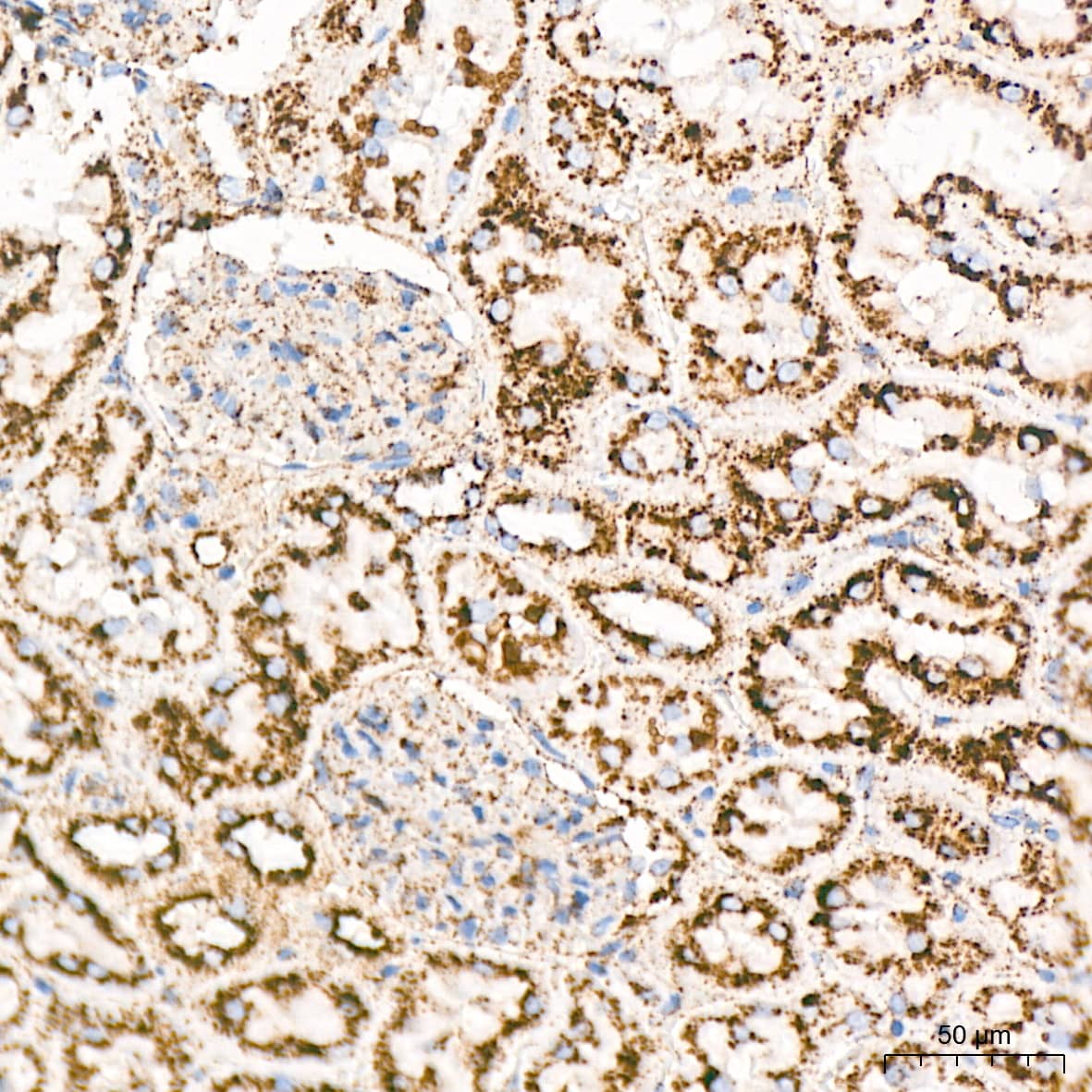 Immunohistochemistry: LIMPII/SR-B2 Antibody (7D2P5) [NBP3-16779] - Immunohistochemistry analysis of LIMPII/SR-B2 in paraffin-embedded rat kidney tissue using LIMPII/SR-B2 Rabbit mAb  at a dilution of 1:1000 (40x lens).High pressure antigen retrieval was performed with 0.01 M citrate buffer (pH 6.0) prior to IHC staining.