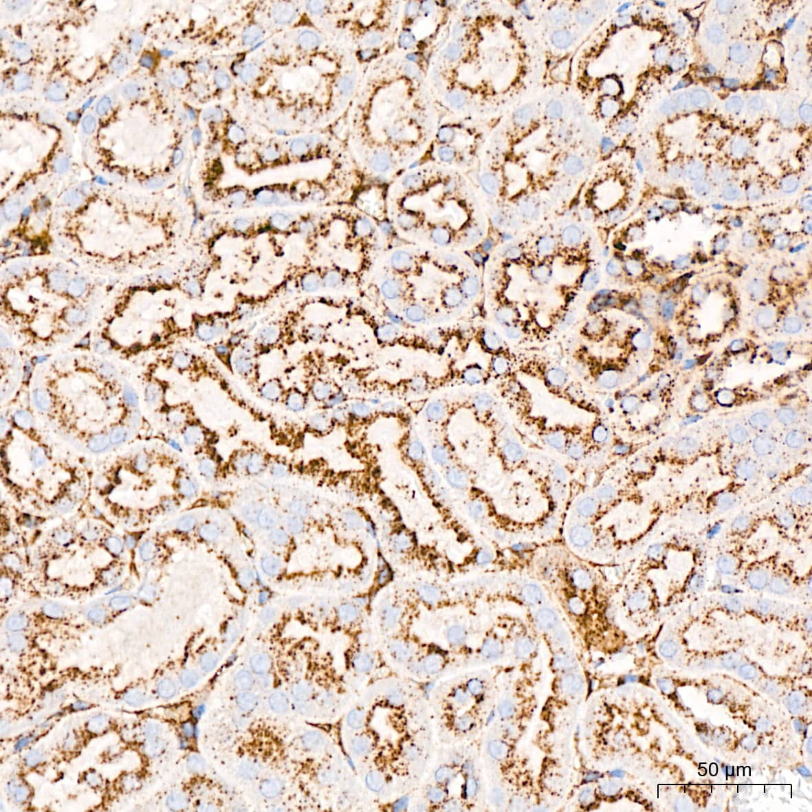 Immunohistochemistry: LIMPII/SR-B2 Antibody (7D2P5) [NBP3-16779] - Immunohistochemistry analysis of LIMPII/SR-B2 in paraffin-embedded mouse kidney tissue using LIMPII/SR-B2 Rabbit mAb  at a dilution of 1:1000 (40x lens).High pressure antigen retrieval was performed with 0.01 M citrate buffer (pH 6.0) prior to IHC staining.