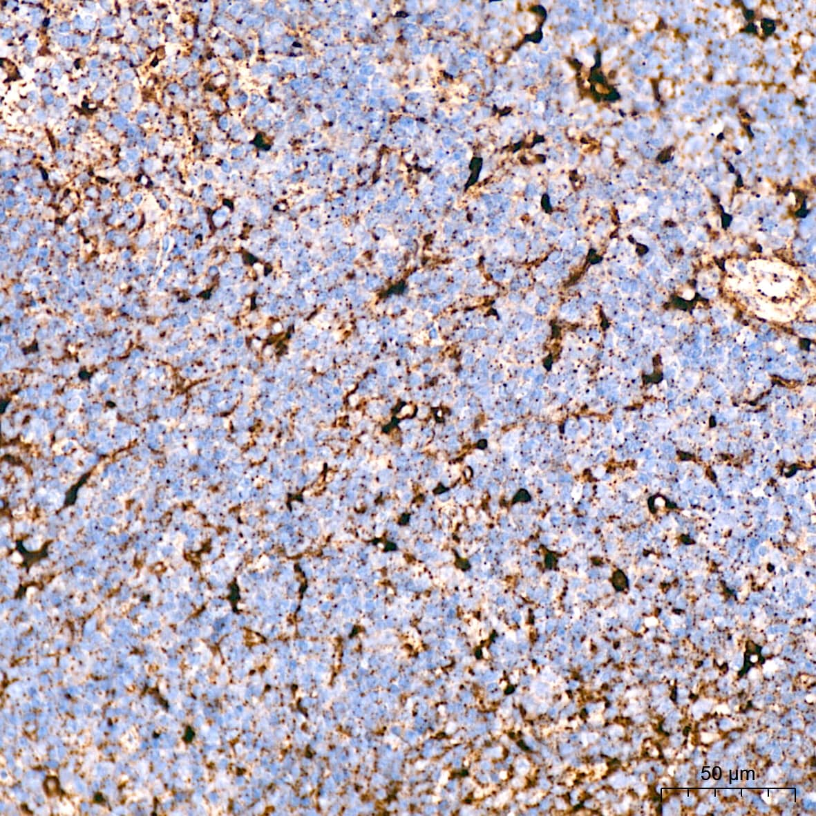 Immunohistochemistry: LIMPII/SR-B2 Antibody (7D2P5) [NBP3-16779] - Immunohistochemistry analysis of LIMPII/SR-B2 in paraffin-embedded mouse spleen tissue using LIMPII/SR-B2 Rabbit mAb  at a dilution of 1:1000 (40x lens).High pressure antigen retrieval was performed with 0.01 M citrate buffer (pH 6.0) prior to IHC staining.