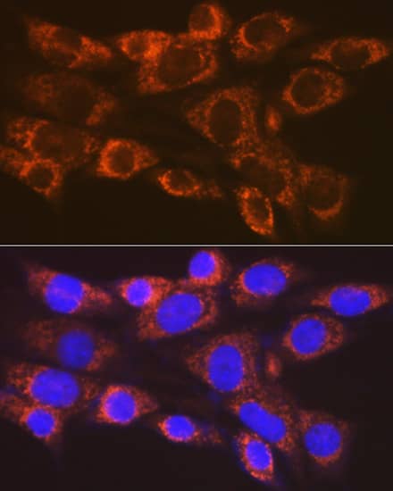 Immunocytochemistry/ Immunofluorescence: ARF1 Antibody (0C5B3) [NBP3-16782] - Immunofluorescence analysis of NIH-3T3 cells using ARF1 Rabbit mAb  at dilution of 1:100 (40x lens). Blue: DAPI for nuclear staining.