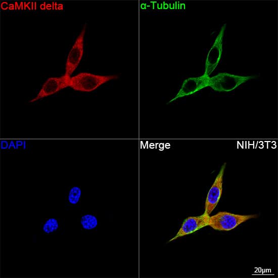 Immunocytochemistry/ Immunofluorescence: CaM Kinase II delta Antibody (10M1P2) [NBP3-16783] - Confocal imaging of NIH/3T3 cells using CaM Kinase II delta Rabbit mAb  ollowed by a further incubation with Cy3 Goat Anti-Rabbit IgG (H+L) . The cells were counterstained with alpha-Tubulin Mouse mAb followed by incubation with ABflo(R) 488-conjugated Goat Anti-Mouse IgG (H+L) Ab (Green). DAPI was used for nuclear staining (Blue). Objective: 100x.