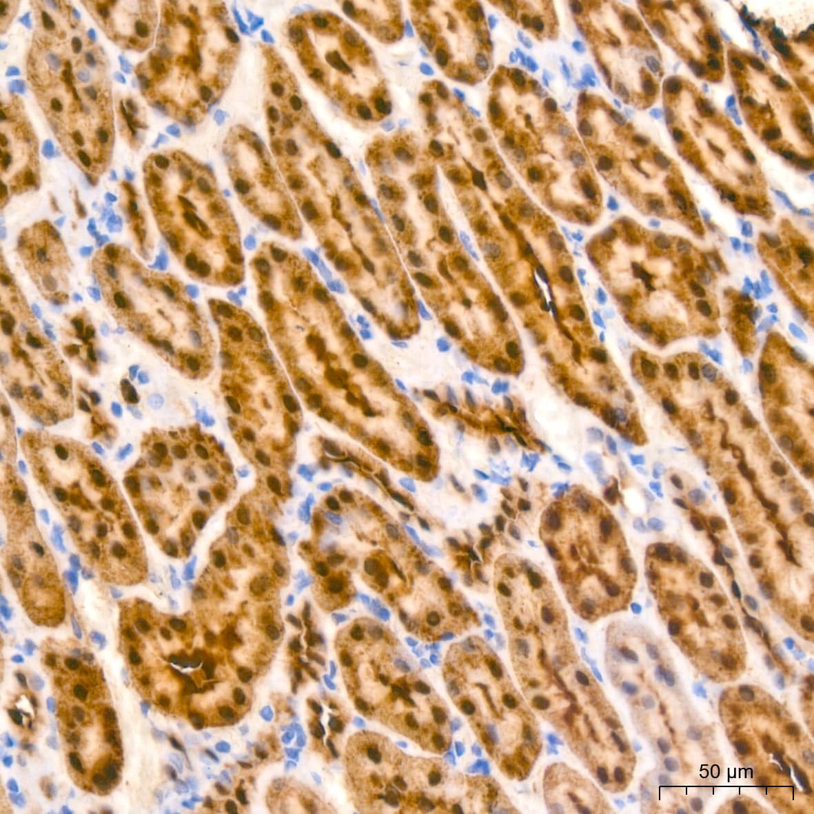 Immunohistochemistry: ABH1 Antibody (5K4W5) [NBP3-16787] - Immunohistochemistry analysis of paraffin-embedded Rat kidney tissue using ABH1 Rabbit mAb at a dilution of 1:200 (40x lens). High pressure antigen retrieval performed with 0.01M Citrate Bufferr (pH 6.0) prior to IHC staining.