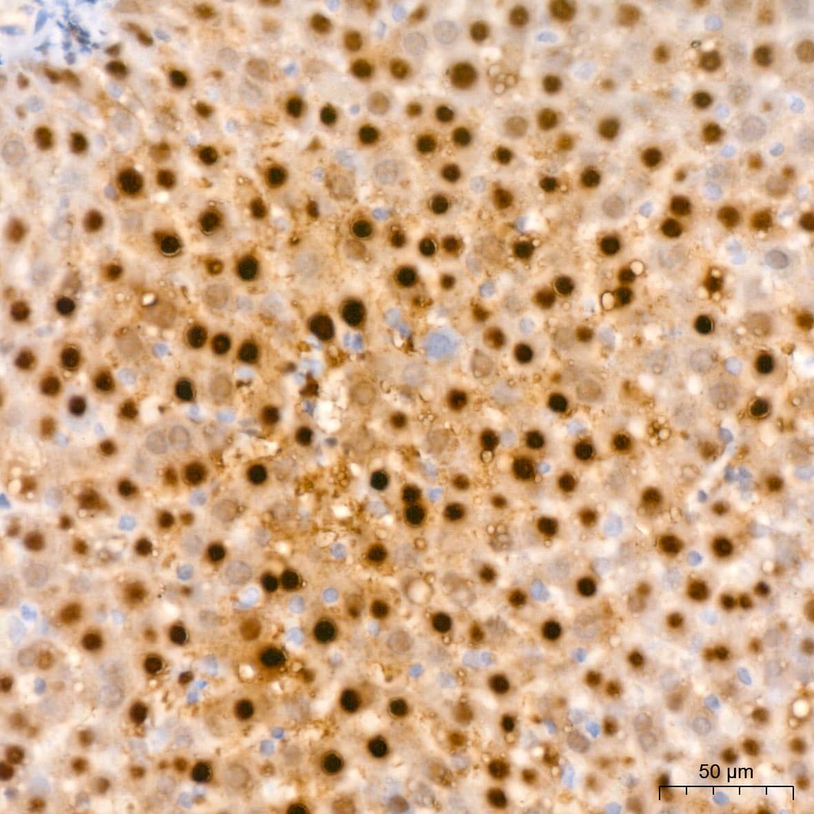 Immunohistochemistry: ABH1 Antibody (5K4W5) [ABH1] - Immunohistochemistry analysis of paraffin-embedded Rat liver tissue using ABH1 Rabbit mAb  at a dilution of 1:200 (40x lens). High pressure antigen retrieval performed with 0.01M Citrate Bufferr (pH 6.0) prior to IHC staining.