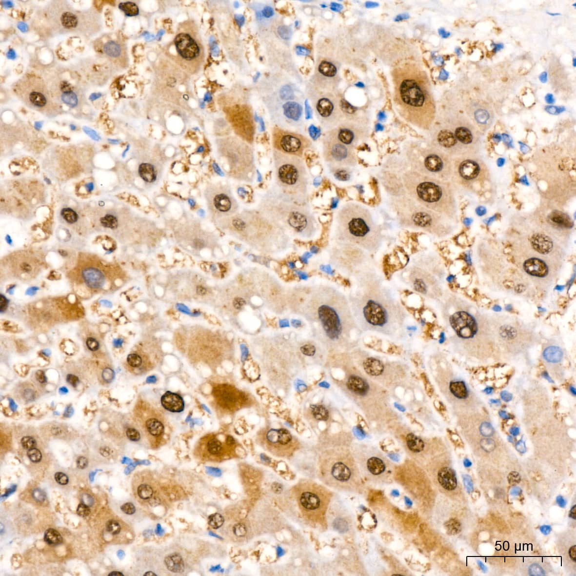 Immunohistochemistry: ABH1 Antibody (5K4W5) [ABH1] - Immunohistochemistry analysis of paraffin-embedded Human liver tissue using ABH1 Rabbit mAb  at a dilution of 1:200 (40x lens). High pressure antigen retrieval performed with 0.01M Citrate Bufferr (pH 6.0) prior to IHC staining.