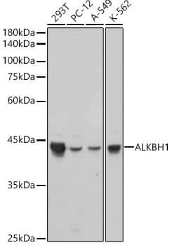 Western Blot ABH1 Antibody (5K4W5)