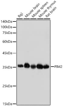 Western Blot: PIM2 Antibody (3V1S5) [NBP3-16789] - Western blot analysis of various lysates, using PIM2 Rabbit mAb  at 1:1000 dilution.Secondary antibody: HRP Goat Anti-Rabbit IgG (H+L)  at 1:10000 dilution.Lysates/proteins: 25ug per lane.Blocking buffer: 3% nonfat dry milk in TBST.Detection: ECL Basic Kit .Exposure time: 5s.